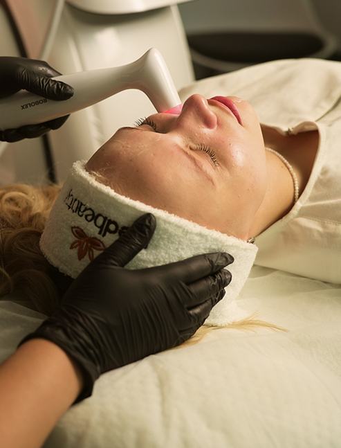 LUMECCA laser removal of blood vessels