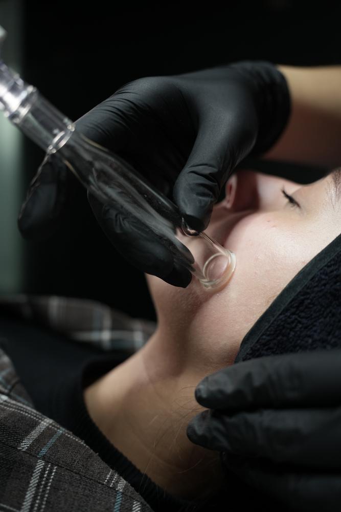 Вакуумне очищення HYDRAFACIAL
