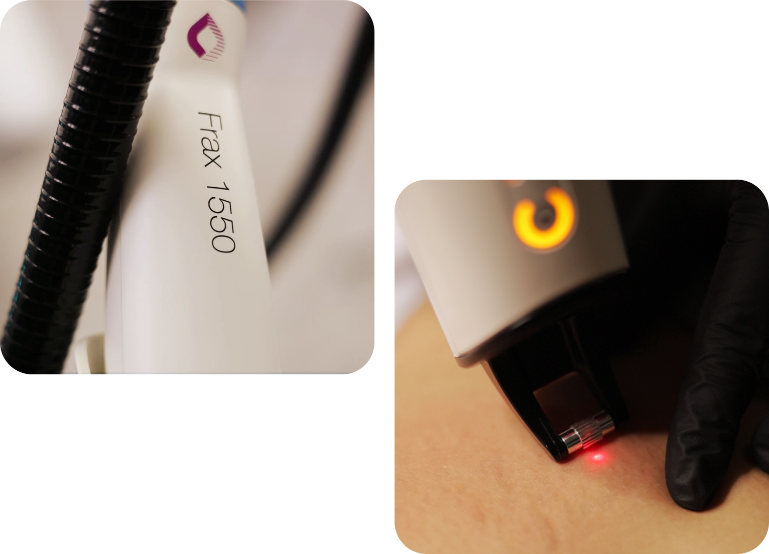 FRAX Pro 1550